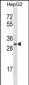 OR4C12 Antibody (C-term)